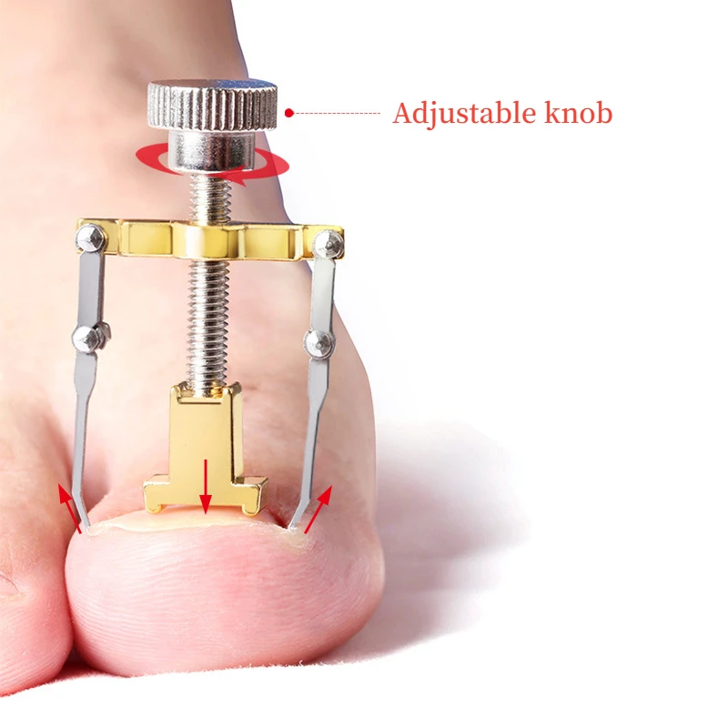 Ingrown Toe Nail Recover Correction Tool Pedicure Toenail Fixer Foot Nail Care Tool Orthotic Corrector Pedicure
