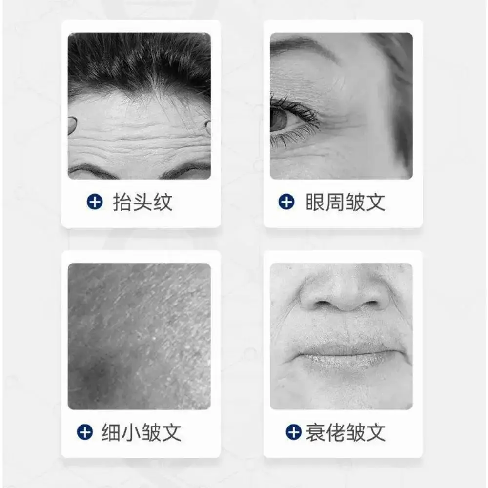 Collagen Freeze-Dried Powder Oligopeptide Repair Facial Anti-Aging 1 Pairs Crow's Feet and Forehead Wrinkles Skin Care facial serum,facial essence,collagen face serum,facial anti wrinkles product