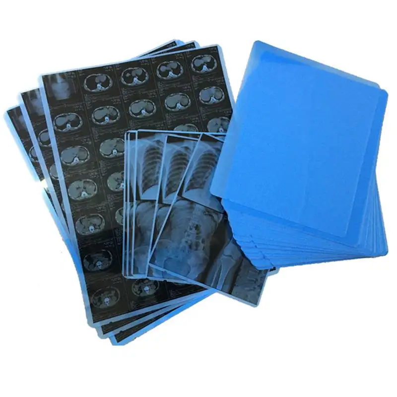 AIEX Selbstklebendes Vinylpapier – 25 Blätter A4, Matt, Wasserdicht, Für Laser & Tintenstrahldrucker