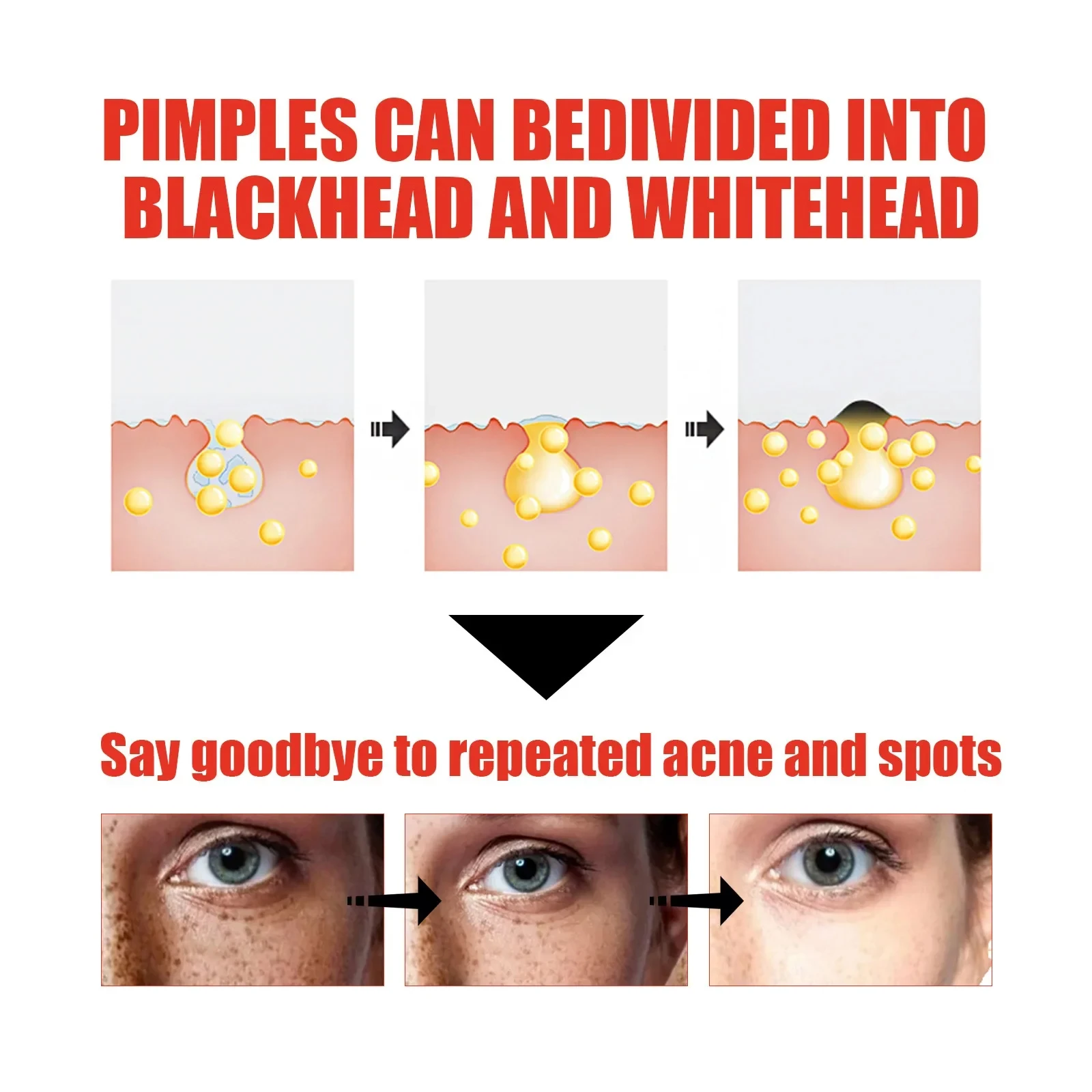 Powerful Spot-removing Whiten Facial Serum Niacinamide Salicylic Acid Moisturizing Korean Skin Care Products 2024 3