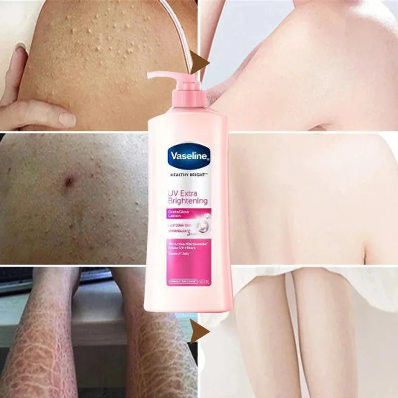 Vaseline Niacinamide Body Lotion Relieves Dry and Dehydrated Skin Exfoliates and Brightens Skin Tone Hydrating 400ml