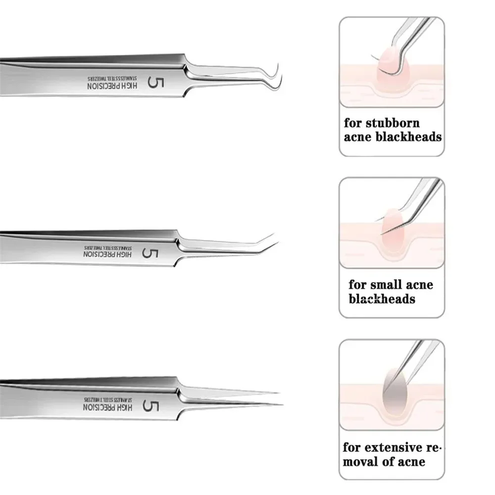 German Ultra-fine No. 5 Cell Pimples Blackhead Clip Tweezers Beauty Salon Special Scraping & Closing Artifact Acne Needle Tools precision tweezers tweezer tool pimples blackhead tweezers blackhead clip tweezers cosmetic tool