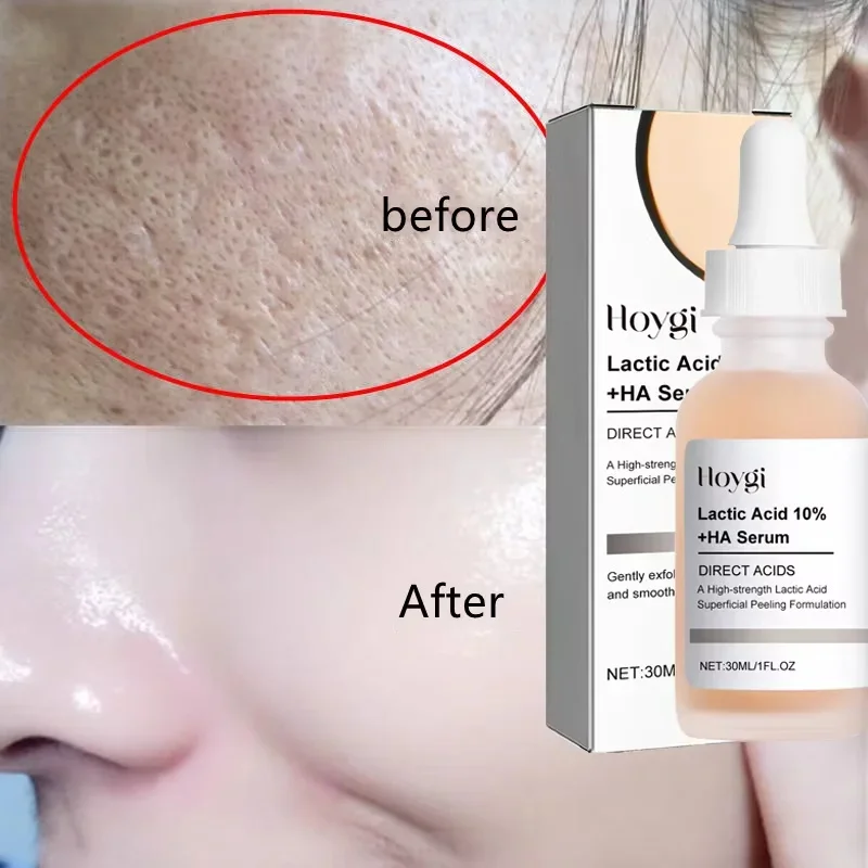 Remove Large Pores Serum Lactic Acid Facial Pore Shrinking Repairing Products Pore Minimizing Firming Smooth Korean Skin Care 3