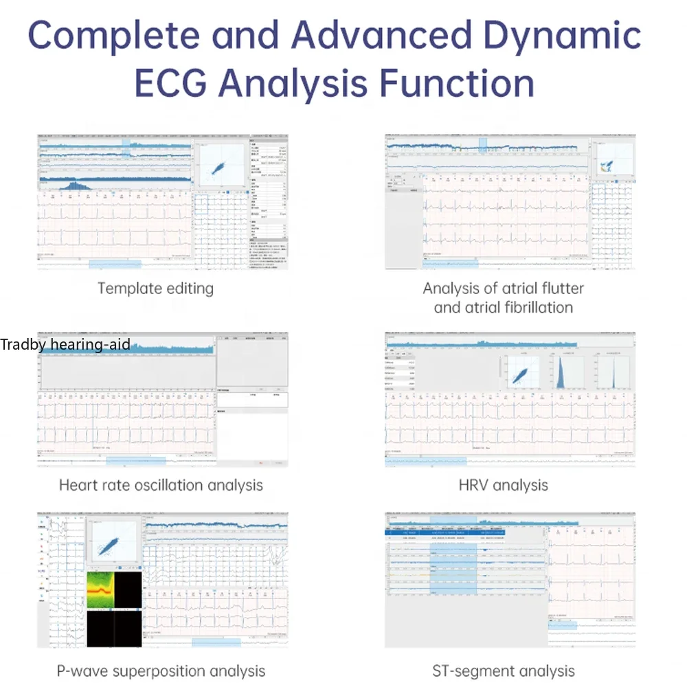 72 Hour AI ECG 12 Channel Holter ECG EKG,Rechargeable ,12/3 Channel ,AI-ECG Tracker Report,50G,Real-timewaveform Display