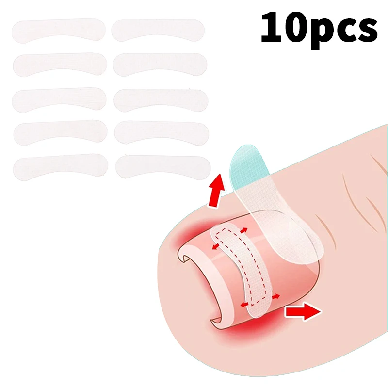 10Pcs Eingewachsene Zehennagel Korrektur Werkzeug Richt Clip Klammer Eingewachsene Zehennagel Behandlung Elastische Patch Aufkleber Pediküre Werkzeug – Detail 3