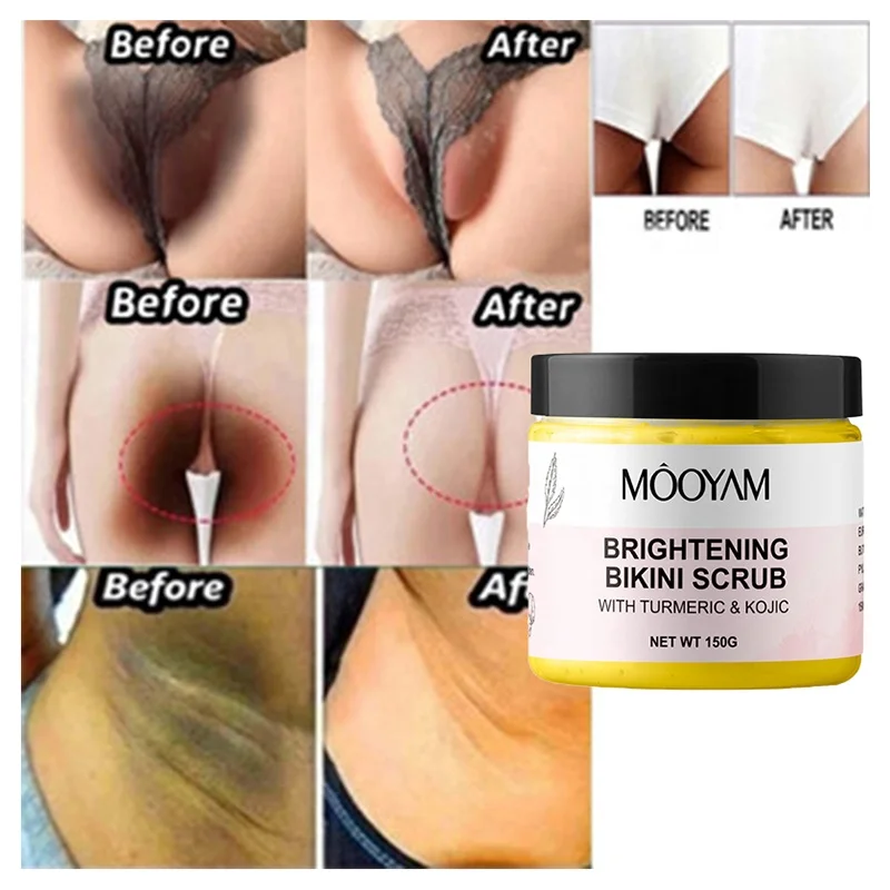 

Kojic Acid Turmeric Bikini Body Scrub remove dark spots Whitening Bright Underarm Bikini Scrub for Ingrown Hair