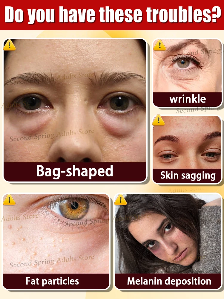 Eye Bag Solution Over 90% Buyer Says Eyes Bag Never Issue