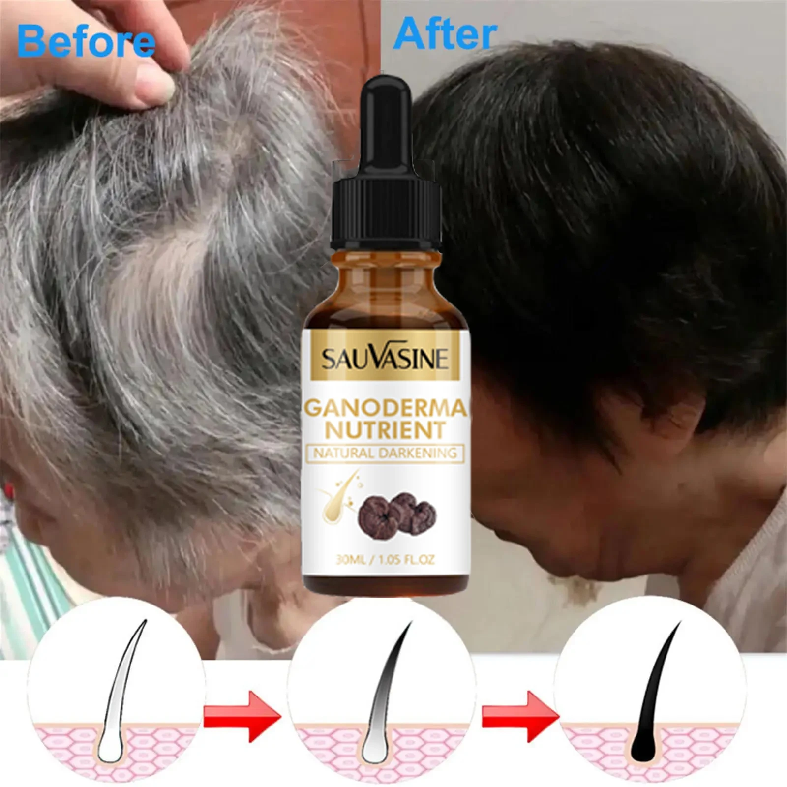 

Gray White Hair Treatment Serum White to Black Natural Color Repair Anti Loss Prevent Baldness Nourish Scalp Hair Care Products
