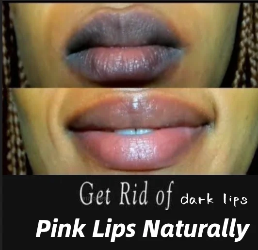 Lips Pink Fresh Fast Lightening Bleaching Cream Balm Treatment Remove Dark Lips LIGHTEN & CHAPPED Lip Balm Wholesale