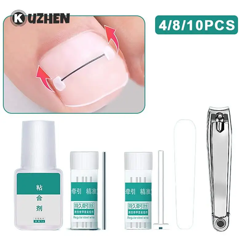 

Ingrown Toenail Corrector Tools Pedicure Recover Embed Toe Nail Treatment Professional Ingrown Toenail Straightening Clip Brace