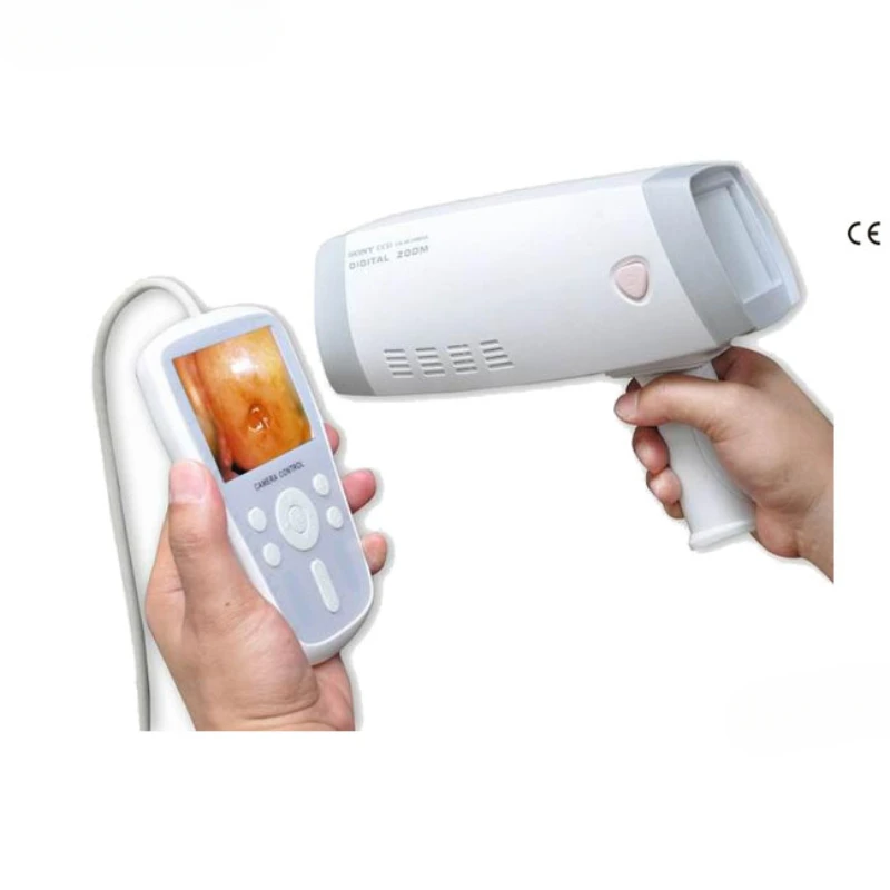 

Portable Digital Colposcopy Handheld Gynecological Video