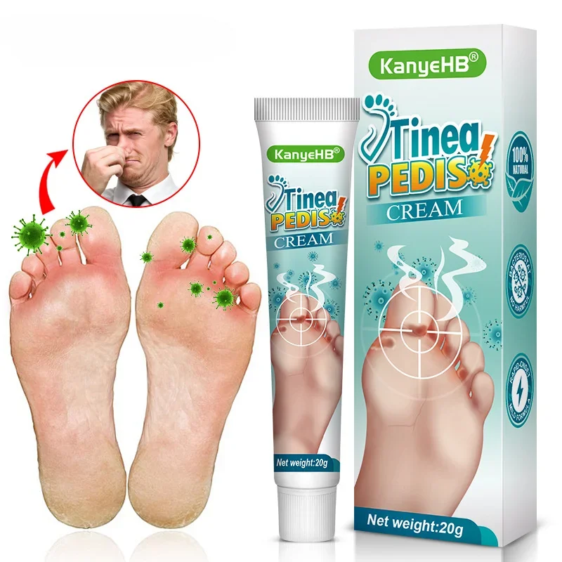Foot Deodorant Cream Foot Odor Bacteriostasis Antipruritic Athlete's Ointment Skin Topical Cream Desodorante Para Pies foot deodorant cream