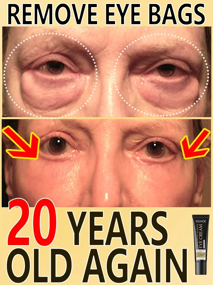 

Anti Wrinkle Eye Cream Remove Eye Bags Puffiness Lifting Firming Smooth Skin Care Moisturizing Instant Eye Massage Cream 2023