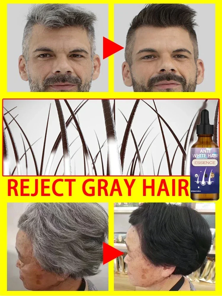 R&eacute;soudre les probl&egrave;mes de cheveux blancs &agrave; partir de la racine des cheveux pour restaurer la couleur naturelle des