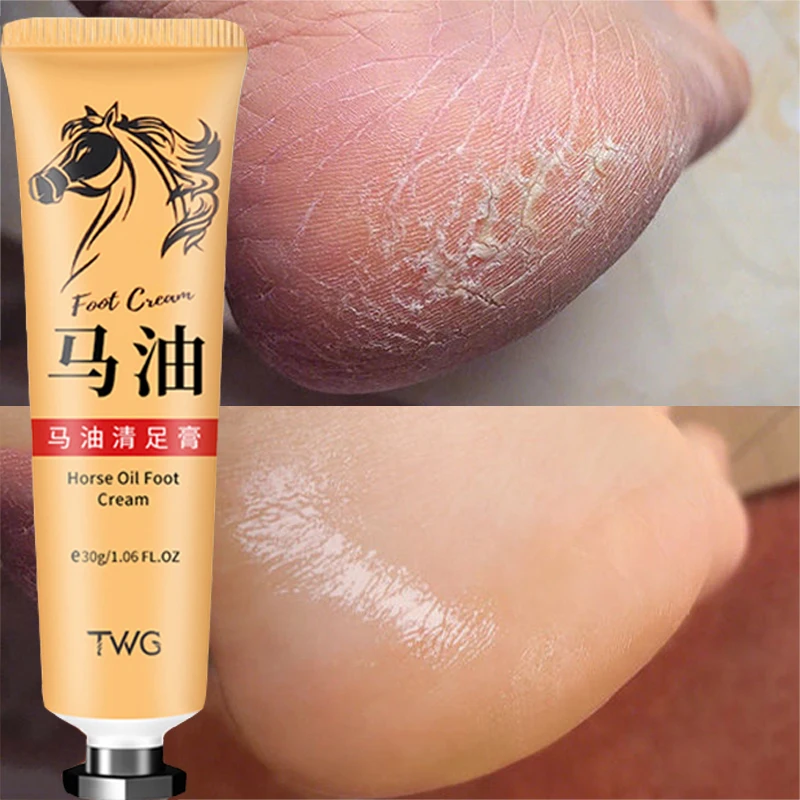 Anti Crack Foot Cream Heel Cracked Repair Horse Oil Cream Smooth Removal Dead Skin Callus Anti-Drying Hand Feet Skin Care 30g horse feathers words are dead 1 cd