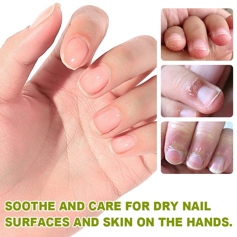 1 قطعة كريم الكيراتين للإصبع تحسين البشرة الجافة ت...