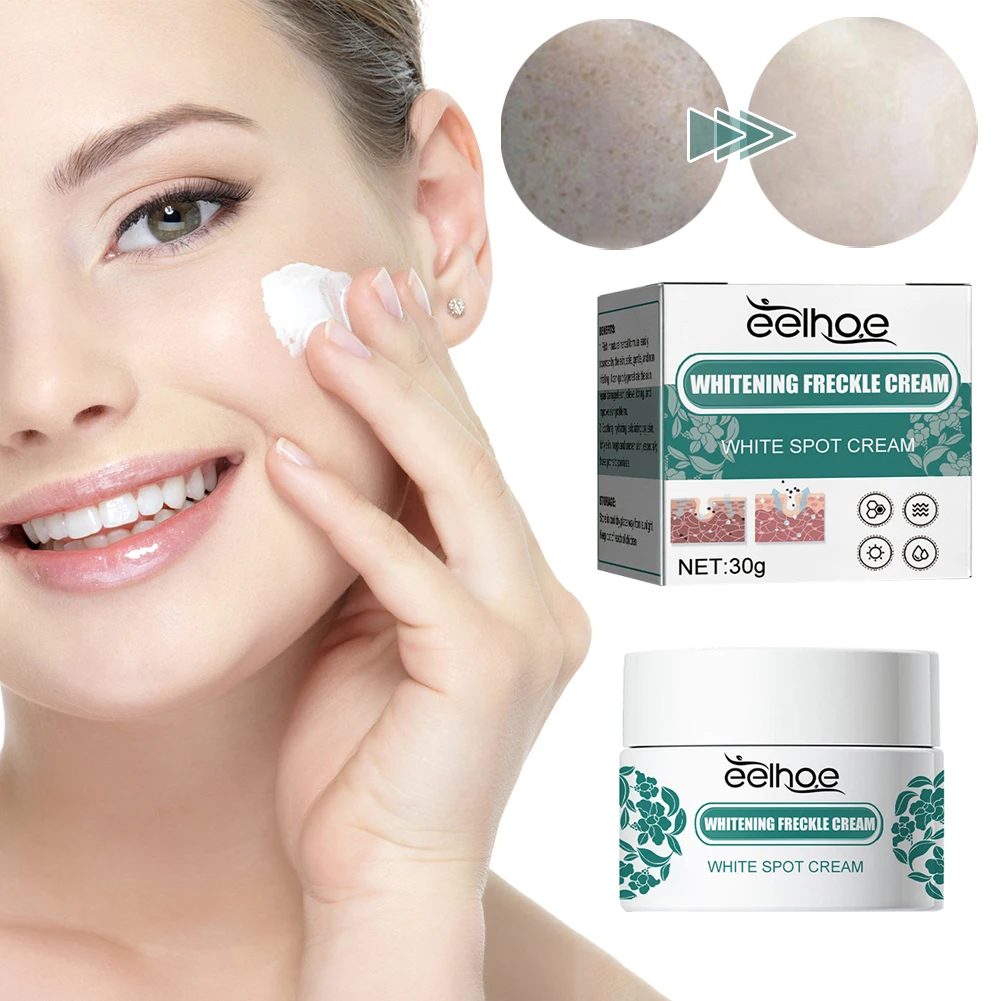 

30 г крем для отбеливания веснушек с Ниацинамид Увлажняющий Осветляющий крем для всех типов кожи товары для ухода за лицом