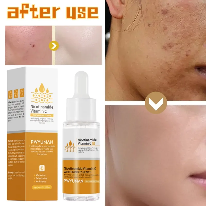 

Niacinamide Whitening Dark Spot Serum Brightening Skin Melanin Reduction Removal Facial blemishes Skincare Original Products