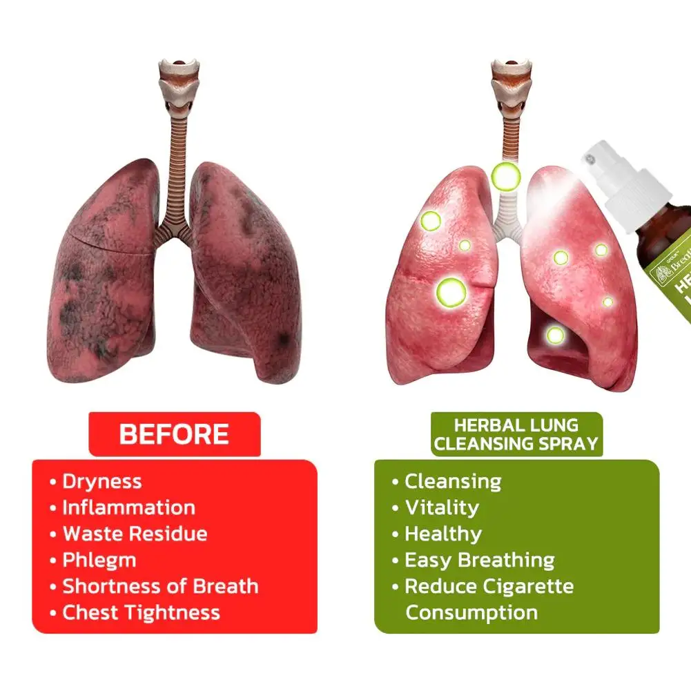 Nasal Spray Herbal Lung Drops Herbal Oral Spray Smoking Cessation Spray 30ML for Lung Herbal Cleanser Smokers Clear Nasal Mist Anti Snoring Congestion Relieves Dry Throat Breath