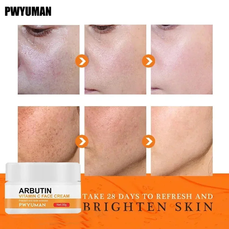 Dark Spots Remover Whitening Face Set Freckle Melanin Correcting Reduce Fine Lines Brighten Essence Korean Beauty Skin Care
