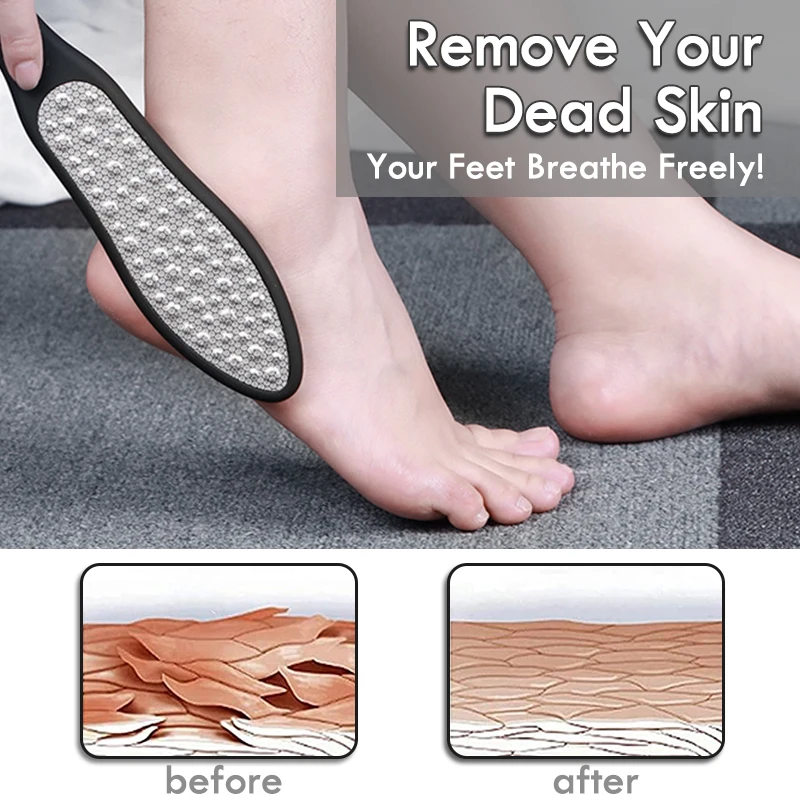 3In1 Professional Pedicure Foot Care Tools File For Heels Cleaning Rasps Grater Callus Callus Dead Skin Remover Feet Sandpaper - Image 3
