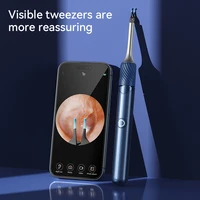 Visual Ear Cleaner with Camera Ear Wax Removal Tool with Ear Pick & Tweezers 12 Megapixels 6 Ear Spoons Earwax Removal Ears Care 2