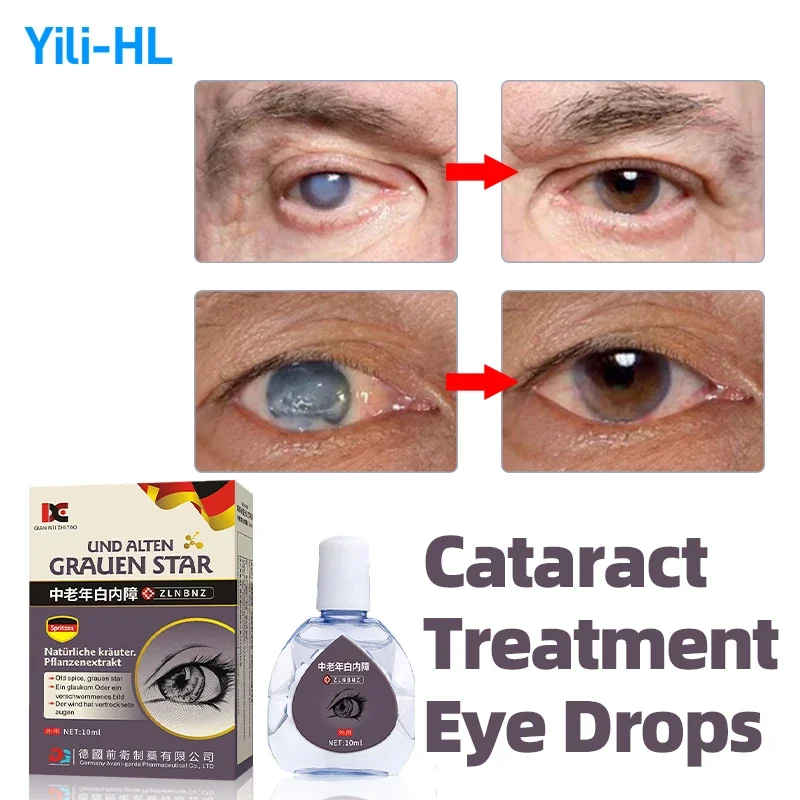 

Cataract Removal Eye Drops Blurred Vision Treatment Apply To Pain Dry Itchy Eyes Fatigue Cleaner Medicine German Secret Recipe