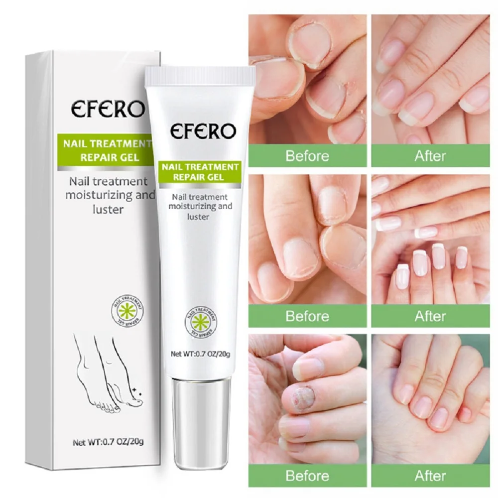 

Nail Growth Promoter Calcium Silicate Collagen Jojoba For Cracked And Fragile Nails Vegetarian Nail Growth Essence