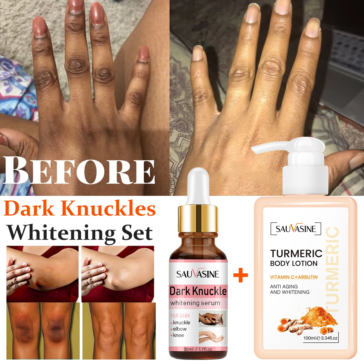 2pcs Dark Knuckle Whitening Serum Turmeric Body Lotion Remove Dark Spots Brighten Hand Knuckle