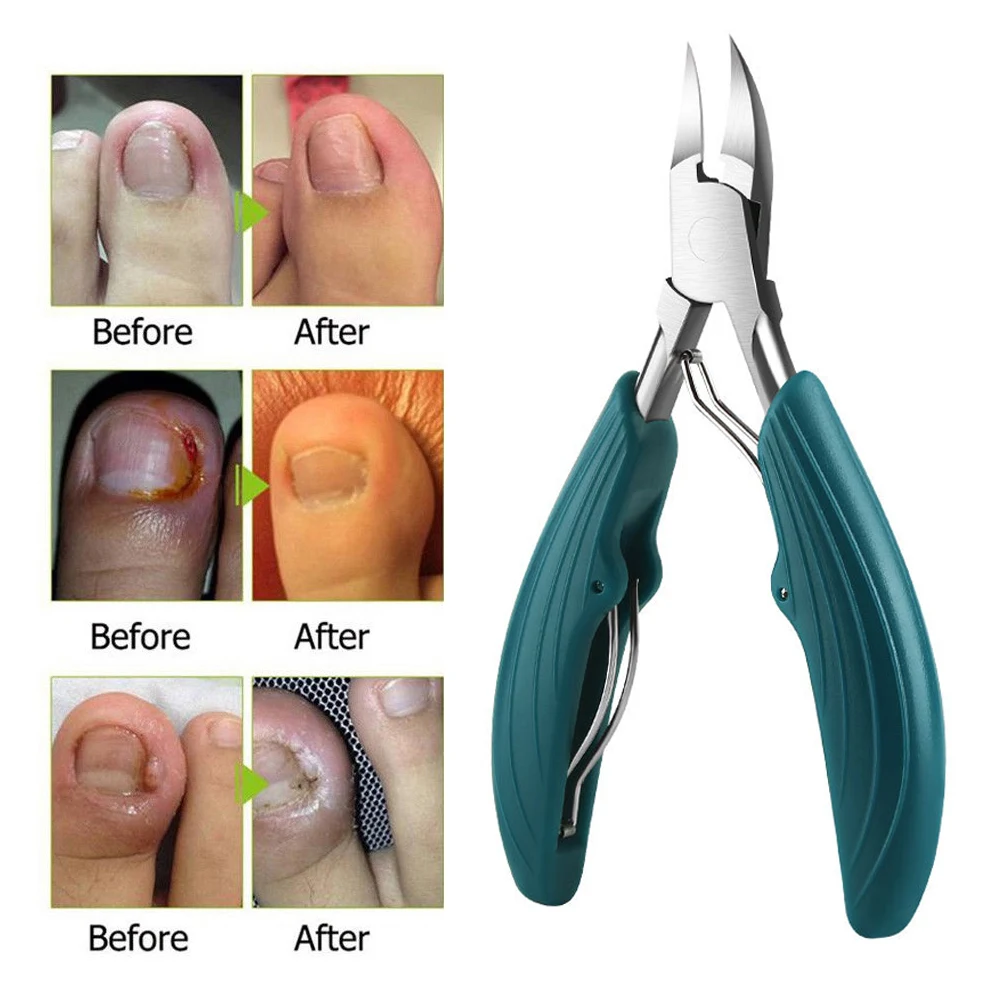 Podiatrist Toenail Clippers Ingrown or Thick Toe Nail Clippers for Men,  Toenail Cutters Nipper Precision Diabetic Pedicure Tool Curved Edge, opove  X5