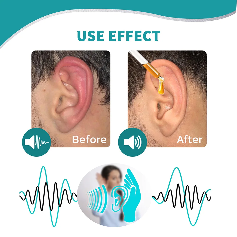 Ear Ringing Treatment Oil Eases Pain Uncloges Ears Anti Hearing Loss