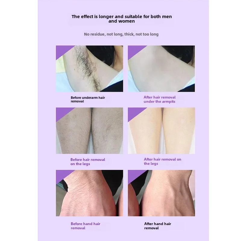 Depilatory Wax Strips Professional Hair Removal for Summer Depilation Double Sided Cold Wax Paper for Leg Body Face
