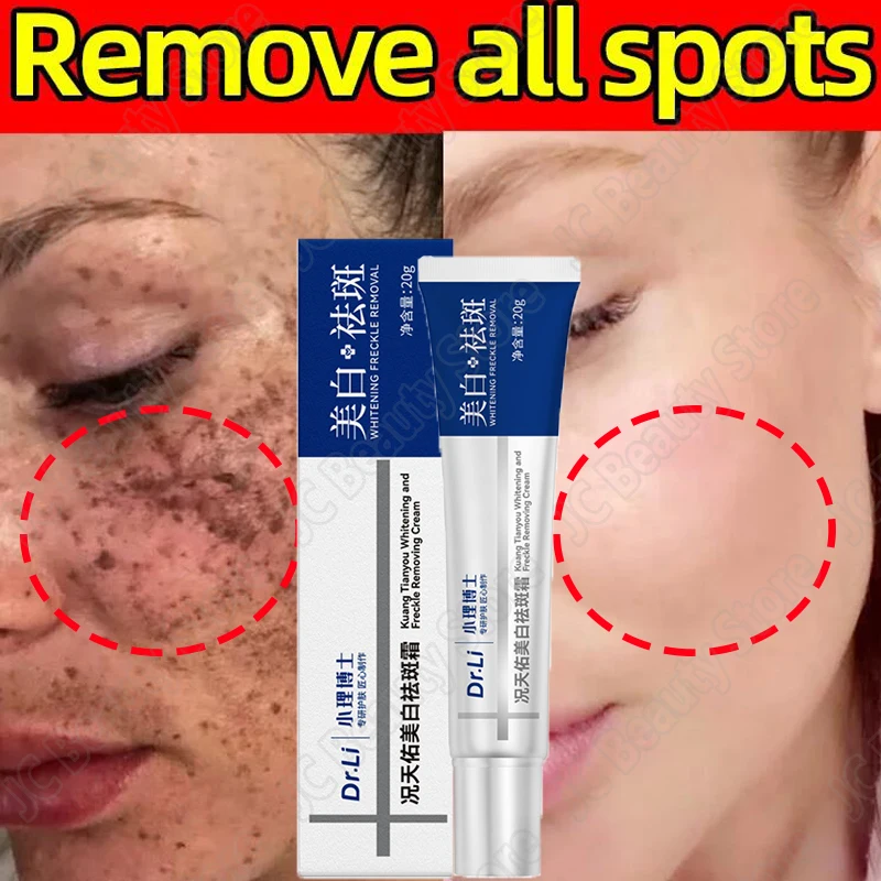 

Nicotinamide Whitening Cream Lighten Freckles Melasma Treatment Pigmentation Ointment Dark Spot Remove Brighten Korean Skin Care