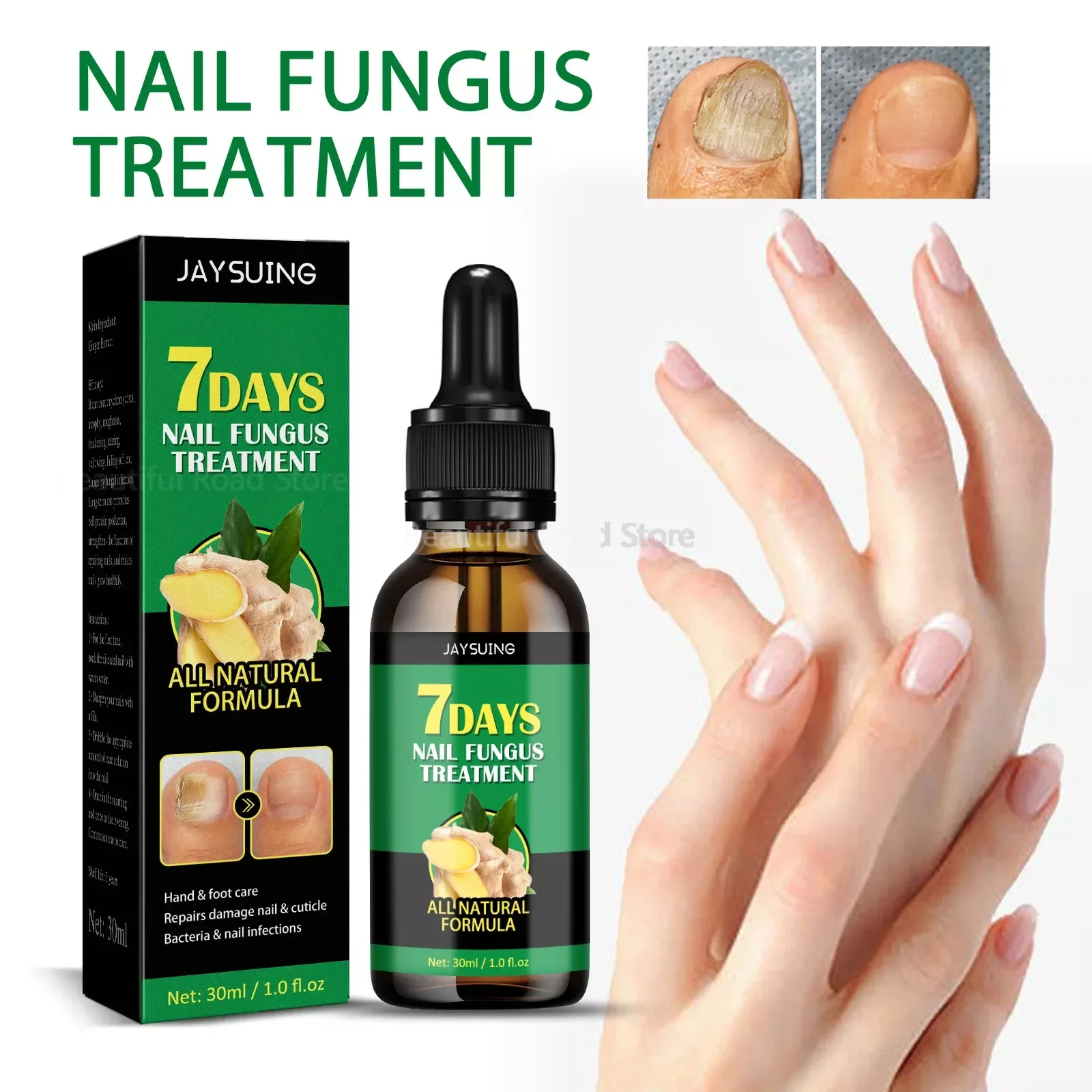 

네일팁Toenail Care Solution Nail Repair Essence for Natural Nail Shine Toenail Care Solution Made with Ginger for Cracked and Rough