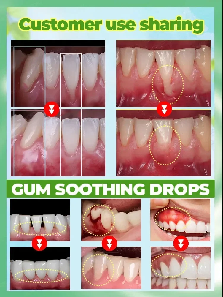 R&eacute;parer les probl&egrave;mes de gencives endommag&eacute;es,soulager la douleur,renforcer probl&egrave;mes de gencives, restaurer salet&eacute;