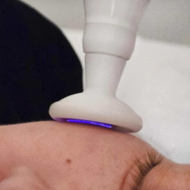 Plasma Pen Professional Machine Fibroblast Ozone Plasma Device Lifting Skin Tightening Wrinkle Acne Remove Beauty Equipment