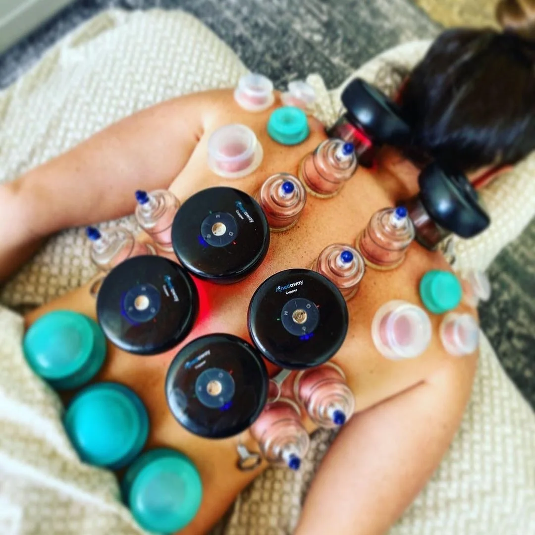 Achedaway Cuppers Cupping Physical Therapy Devices New Cupping physiotherapy tools Physiotherapy Equipment 5