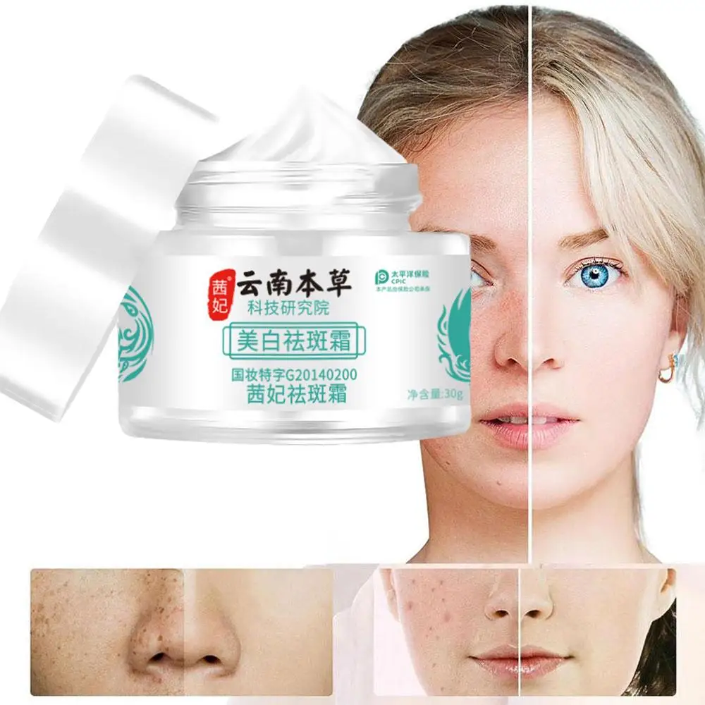 

30g Herb Powerful Whitening Freckle Cream For Dark Spot Correcting Face Moisturizing Brightening Skin Care Beauty V9Q9