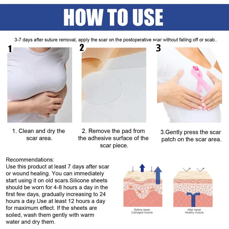 Female Silicone Breast Scar Removal Sheets Stickers Nipples Scar Removal Sticker Acne Trauma Breast Sheets Skin Repair sore healing cream