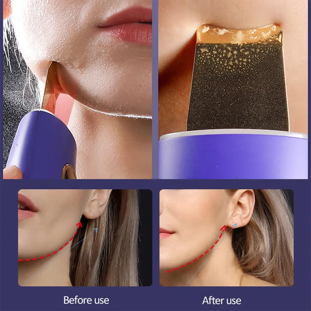 Ultrasonic Skin Scrubber Facial Peeling Blackhead Remover Deep Cleaning Ion Import Ance Pore Cleaner Face Shovel Cleanser
