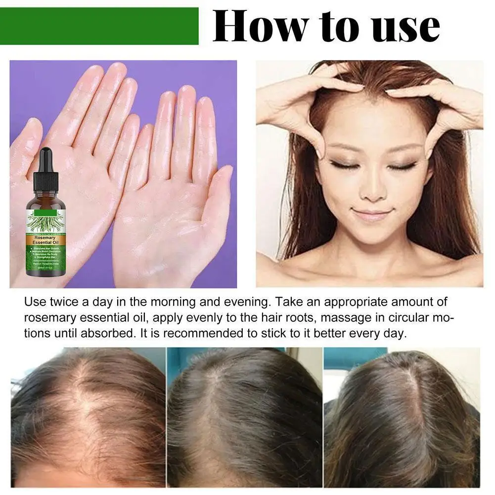 Essential Oil Scalp & Hair Strengthening Rosemary Oil for Hair Growth Repair Damaged Care 30ml Anti Loss