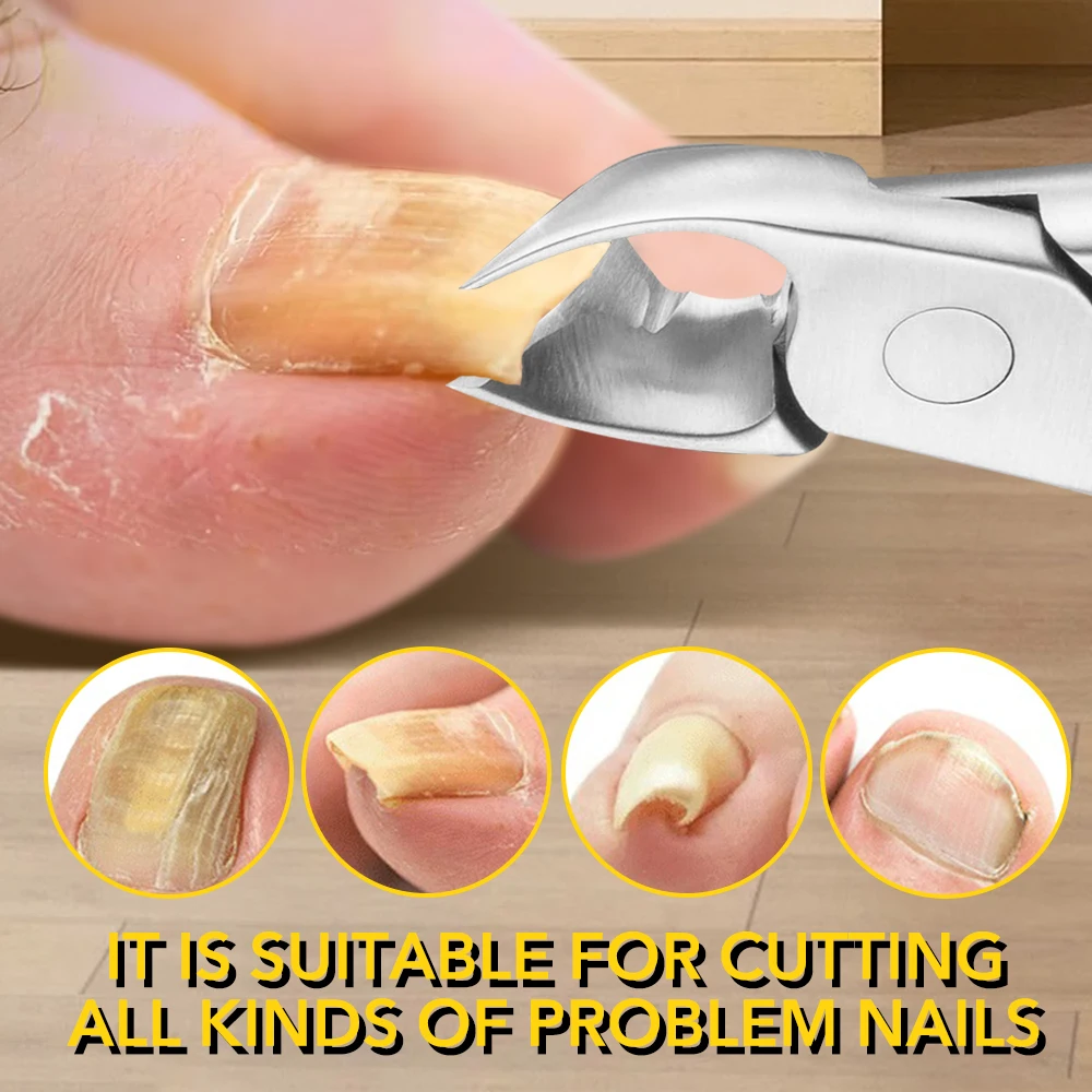Toe Nail Clipper Nail Clipper Set Nail Clipper Nail Care Kit Nail Clippers Manicure Pedicure Kit Manicure Set Manicure Sets Manicure Nail Clipper Set Nail Clippers Kit Stainless Steel Nail Clippers Trimmer Ingrown Pedicure Care Professional Cutting Tools for Feet Toenail Paronychia Improved