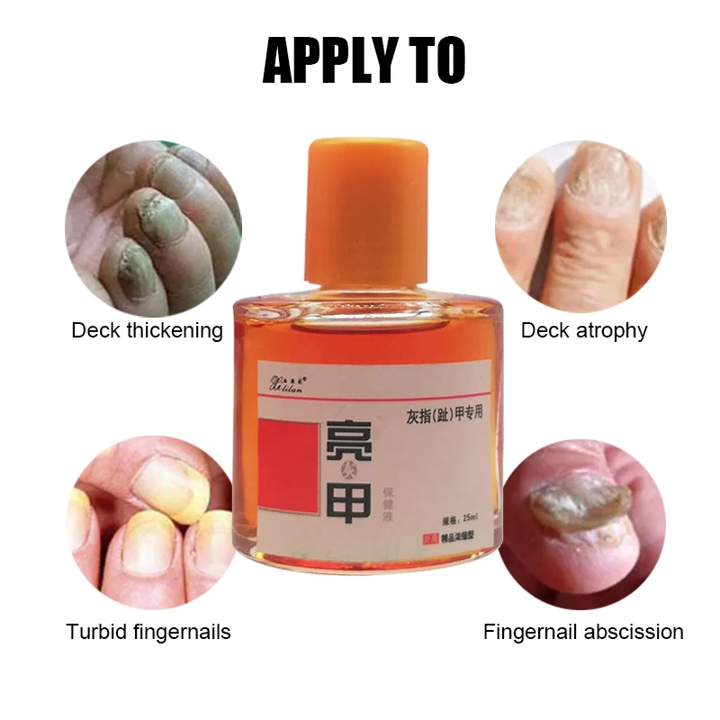 

25ml Natural Nail Fungus Treat Essence Foot Fungal Removal Serum Paronychia Care Dressing Anti-infective Onychomycosis Liquid
