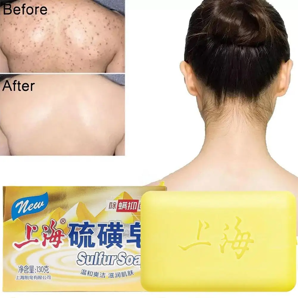 

Newest Shanghai Sulfur Soap Sulphur Soap Acne Treatment Psoriasis Seborrhea Eczema Anti Fungus Bath Healthy Soaps Travel Soap