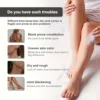 TRSTAY Snow Bleach Is Suitable for Deep Keratosis on the Face and Body, Cleaning and Smoothing 2