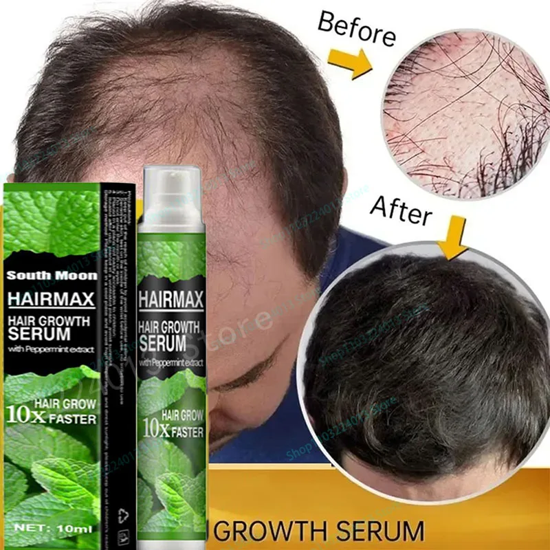 

Fast Hair Growth Hair Growth Oil Effective Baldness Repair Hereditary Hair Loss Postpartum Hair Loss Seborrheic Hair Anti Loss