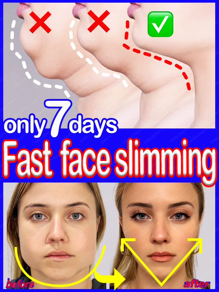 

V Shape Face Slimming Cream Remove Double Chin