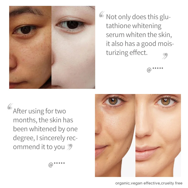 Kojic Acid Face Whitening Serum Glutathion Remove Blemish Dark Spot Correcting Glow Serum Face Skin Care Moisturizer Cosmetics 5