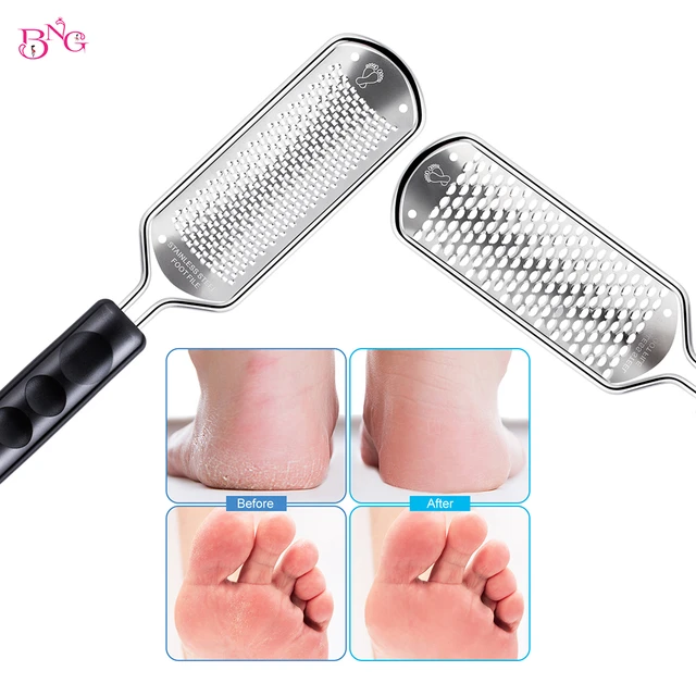 Colossal Foot Rasp Foot File And Callus Remover, Best Foot Care Pedicure  Metal Surface Tool To