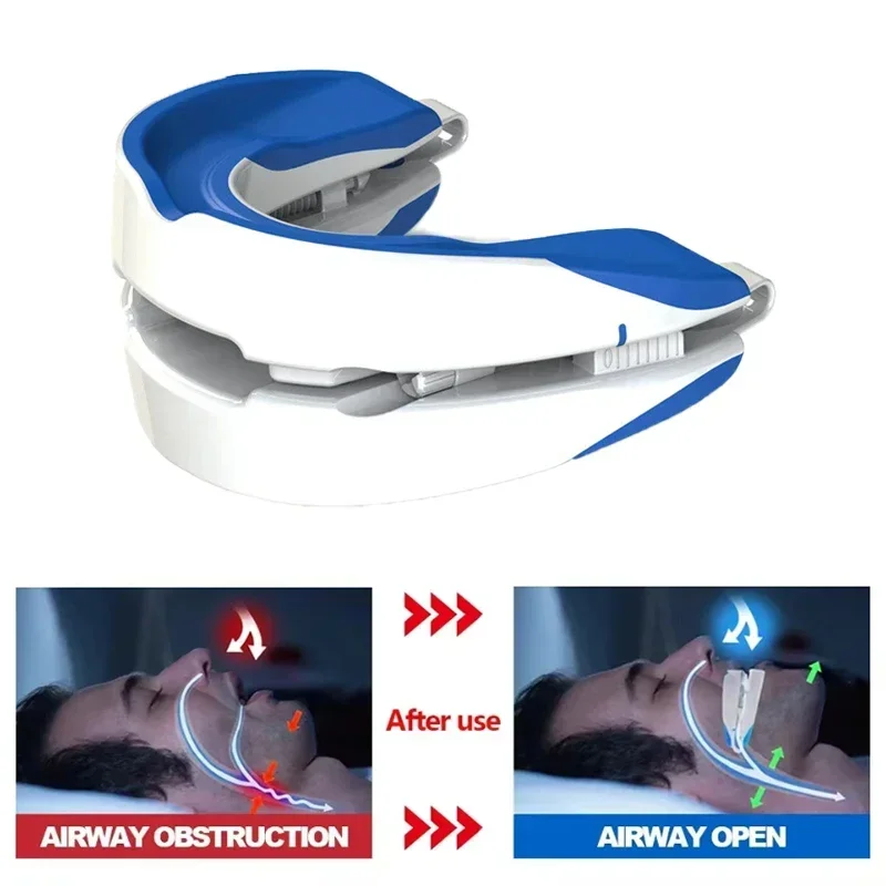 Anti Snoring Mouth Guard Anti-Snoring Mouthpiece Anti-Snoring Device Night Time Teeth Mouthguard Adjustable Sleeping Mouth Guard for Bruxism Stop Snoring